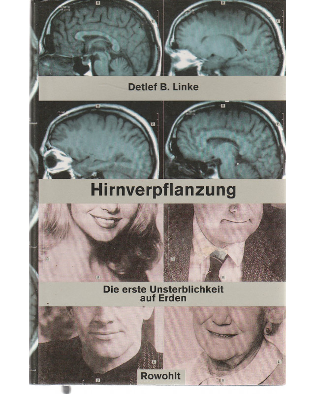 Hirnverpflanzung